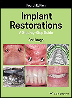Implant Restorations: A Step-by-Step Guide (4th Edition) - Orginal Pdf